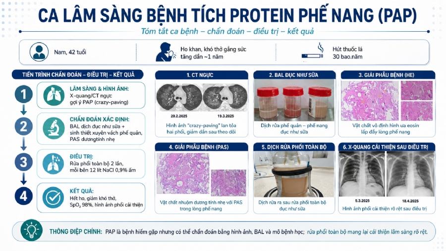 CA LÂM SÀNG BỆNH TÍCH PROTEIN PHẾ NANG